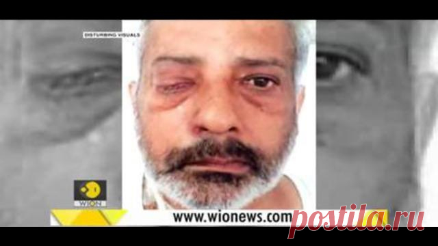 THE COVID-19 VACCINE IS MORE DEADLY THAN YOU THINK MAG BITTER TRUTH. BAM BAM BAM