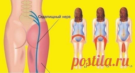 2 простых упражнения для разблокировки седалищного нерва Так легко и быстро! Спасибо за совет, а то я ввыла от боли!