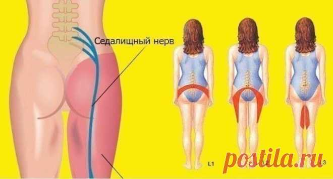 2 простых упражнения для разблокировки седалищного нерва Так легко и быстро! Спасибо за совет, а то я ввыла от боли!