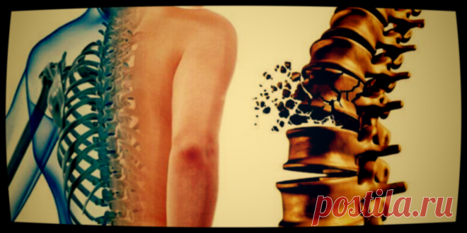 Как не разрушить плотность и прочность: что сохранит кости крепкими до старости | Будь здоров | Яндекс Дзен