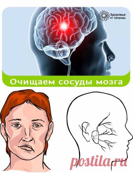 Настой граба очистит сосуды головного мозга