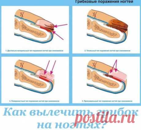 (2) Одноклассники