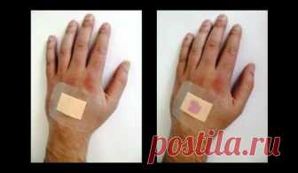 Лечение болезни кошачьих царапин народными средствами Среди инфекционных заболеваний, которые часто поражают не только детей, но и взрослых, одним из наиболее опасных является болезнь кошачьих царапин. Для кого-то игра с забавными пушистыми и такими смешными животными, как котята или щенки, может остаться лишь приятным воспоминанием, а для кого-то...