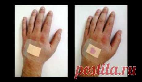 Лечение болезни кошачьих царапин народными средствами Среди инфекционных заболеваний, которые часто поражают не только детей, но и взрослых, одним из наиболее опасных является болезнь кошачьих царапин. Для кого-то игра с забавными пушистыми и такими смешными животными, как котята или щенки, может остаться лишь приятным воспоминанием, а для кого-то...