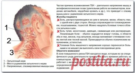 головные боли причины: 21 тыс изображений найдено в Яндекс.Картинках
