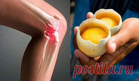 Как использовать 2 яйца для полного исчезновения боли в колени и «ремонта» суставов
Колено является одним из самых важных суставов в нашем скелете. Благодаря этому бедренная кость, малоберцовая мышца и коленная чашечка остаются вместе и могут скользить для создания различных движений, таких как бег, ходьба, сидение и множество движений, которые мы делаем в повседневной жизни.
Износ коленей может вызвать различные неудобства. Наиболее распространенными являются боль и воспа...