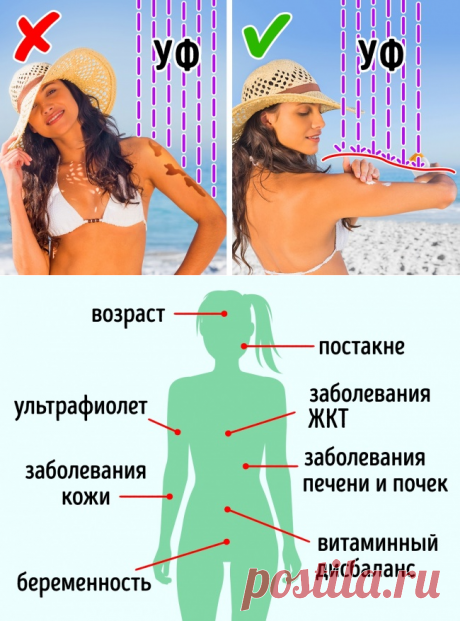 10 средств для кожи, которые стирают пигментные пятна как ластик Основными причинами возникновения пигментных пятен могут быть воздействие ультрафиолетового излучения, возрастные изменения, хронические заболевания печени и почек, последствия акне, беременность, заболевания кожи (экзема, дерматит), витаминный дисбаланс, заболевания желудочно-кишечного тракта. К сожалению, не все могут похвастаться идеальным тоном лица. Но не стоит отчаиваться раньше времени, ведь мы пригото...