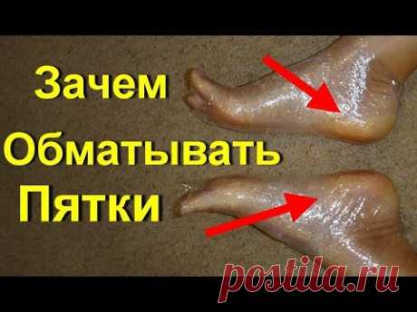 Потрясающий рецепт - гладкие мягкие пятки в домашних условиях за 1 день