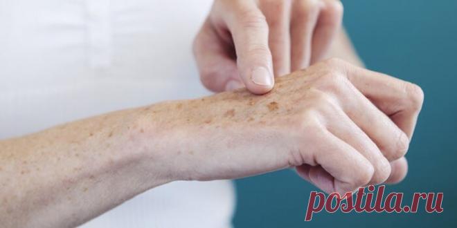Почему появляются возрастные пятна и как избавиться С годами на лице, руках, спине, плечах обнаруживается подозрительная пигментация. Важно понимать, почему появляются возрастные пятна и как их отличить от меланомы.