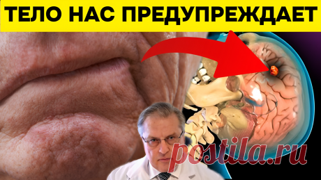 8 сигналов, указывающих на скорый инсульт? Неврологи рассказали, как тело нас предупреждает | Игорь Ботоговский | Дзен