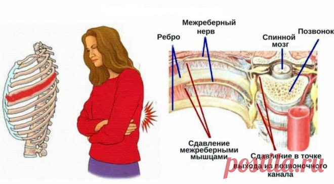 Как я избавился от невыносимой боли в спине за 2 дня | Записки Гиппократа | Яндекс Дзен