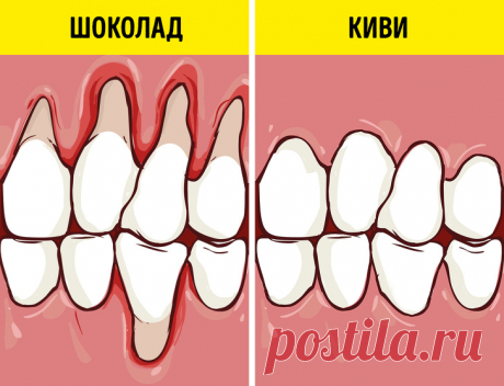 Как сохранить здоровье зубов и отбелить их с помощью еды