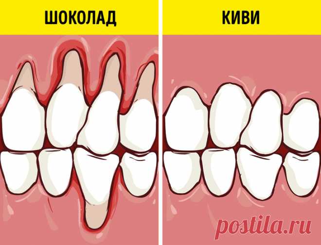 Как сохранить здоровье зубов и отбелить их с помощью еды