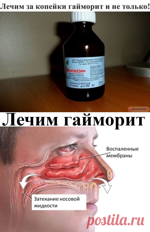 (5) Одноклассники
