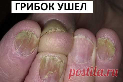 Чудодейственное ощелачивание организма: как принимать соду | Naget.Ru