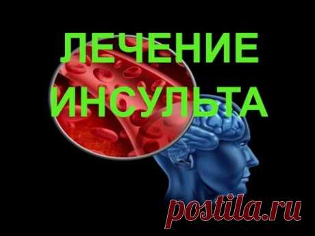 Лечение инсульта: 95 % успеха. Инсульт и его профилактика