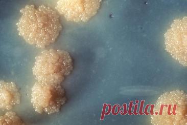 Mycobacterium tuberculosis - Wikipedia