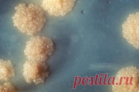 Mycobacterium tuberculosis - Wikipedia