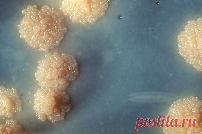 Mycobacterium tuberculosis - Wikipedia