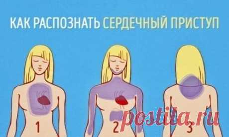 Как распознать сердечный приступ за месяц до того, как он случится