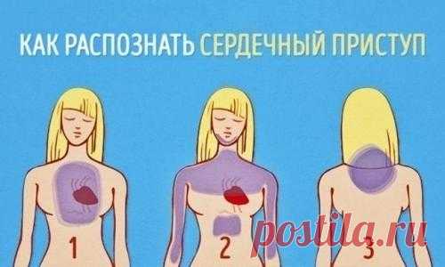 Как распознать сердечный приступ за месяц до того, как он случится