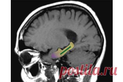 Lenta.ru: Наука и техника: Наука: Какао оказалось мощным средством против старческого слабоумия