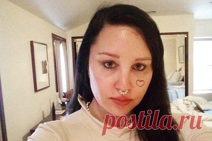 Пережившая нервный срыв звезда фильма «Она — мужчина» рассказала о пластике. Американская актриса Аманда Байнс в личном блоге призналась, что сделала блефаропластику. По словам знаменитости, сейчас она чувствует себя гораздо лучше в собственном теле. 37-летняя звезда фильма «Она — мужчина» заявила, что очень рада, что решилась на хирургическое вмешательство и удалила излишки кожи на веках.