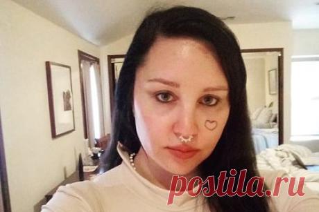 Пережившая нервный срыв звезда фильма «Она — мужчина» рассказала о пластике. Американская актриса Аманда Байнс в личном блоге призналась, что сделала блефаропластику. По словам знаменитости, сейчас она чувствует себя гораздо лучше в собственном теле. 37-летняя звезда фильма «Она — мужчина» заявила, что очень рада, что решилась на хирургическое вмешательство и удалила излишки кожи на веках.