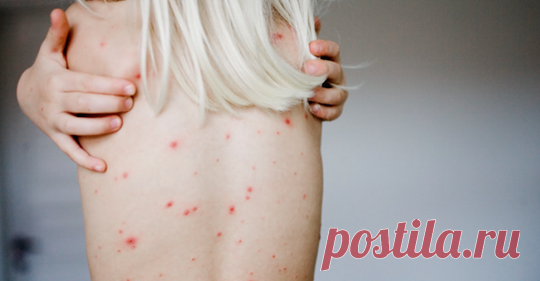 8 симптомов сифилиса у женщин: как узнать, страдаете ли вы от сифилиса