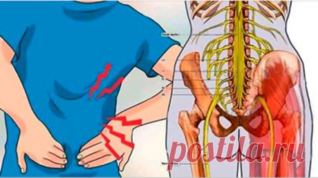 Воспаление седалищного нерва: достаточно 1 легкого упражнения, чтобы избавиться от боли всего за 5 минут! Даже если у вас нет воспаления седалищного нерва, это упражнение стоит делать! Советую, очень простое и действенное упражнение! Седалищный нерв является самым длинным в человеческом теле. Его воспаление вызывает сильную боль, которая простирается от ребер до колен. Когда
