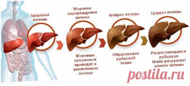 Как быстро и безопасно очистить печень и привести организм в порядок