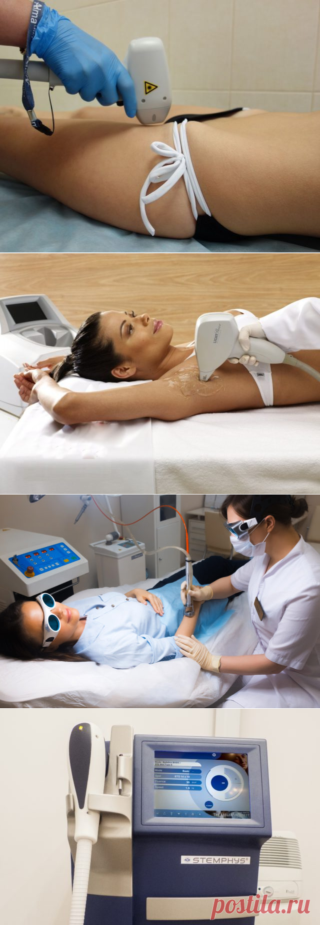 Лазерная эпиляция: больно или нет?