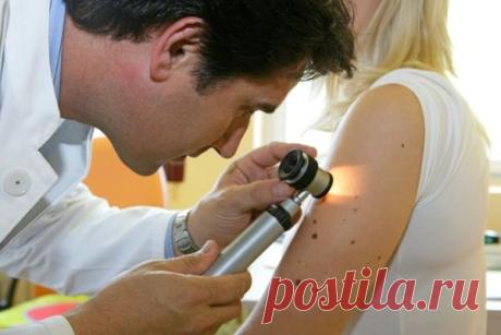 Как отличить меланому от обычной родинки | Айболит. Блог хирурга | Яндекс Дзен