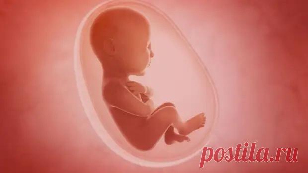 Что такое литопедион?