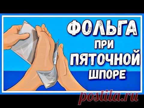 НЕОБЫЧНЫЙ способ лечения ПЯТОЧНОЙ шпоры ФОЛЬГОЙ.