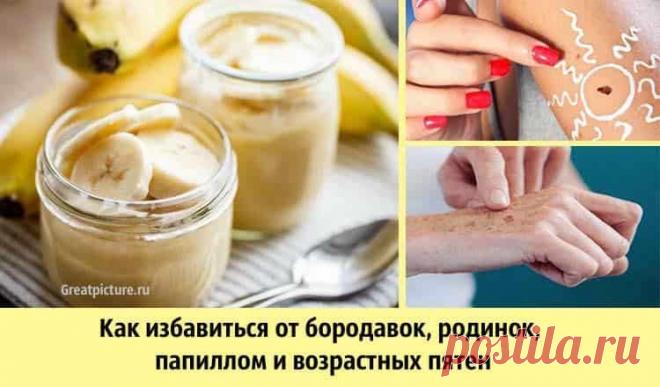 Как избавиться от бородавок, родинок, папиллом и возрастных пятен 

Как избавиться от бородавок, родинок,папиллом и возрастных пятен. Мы представляем вам несколько народных средств, которые помогут решить ваши кожные проблемы.
Большинство из нас в определенный момен…