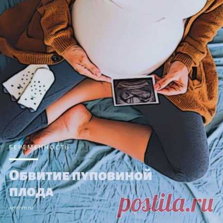Обвитие пуповиной плода: Причины, опасности, последствия | Журнал Амром Обвитие пуповиной плода. Пуповина – это, грубо говоря, длинный кровеносный сосуд, который соединяет ребёнка с организмом матери.
