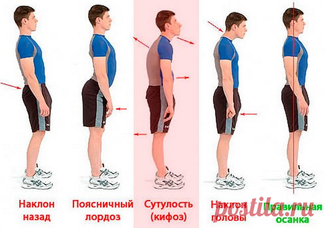 Здоровая спина — красивая осанка — Всегда в форме!