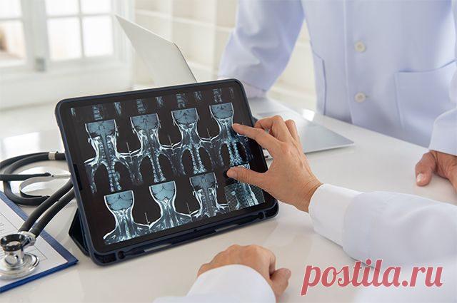 Как продлить жизнь позвоночнику / Будьте здоровы