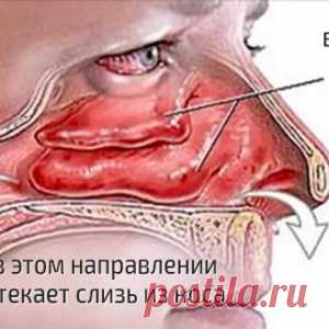 Заложенность и отек носа пройдут через несколько секунд, если просто нажать на эти точки! (ФОТО)