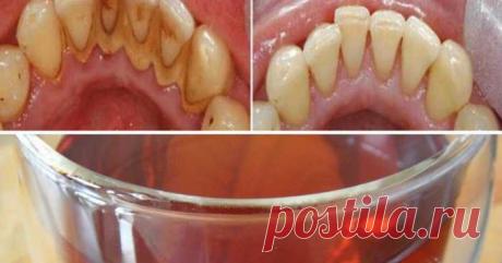 Если вам нужны хорошие здоровые зубы, вы должны прополоскать рот этим чаем! — Домашний уют