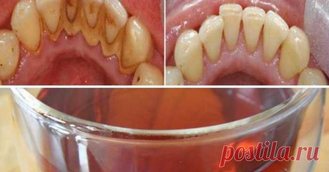 Если вам нужны хорошие здоровые зубы, вы должны прополоскать рот этим чаем! — Домашний уют