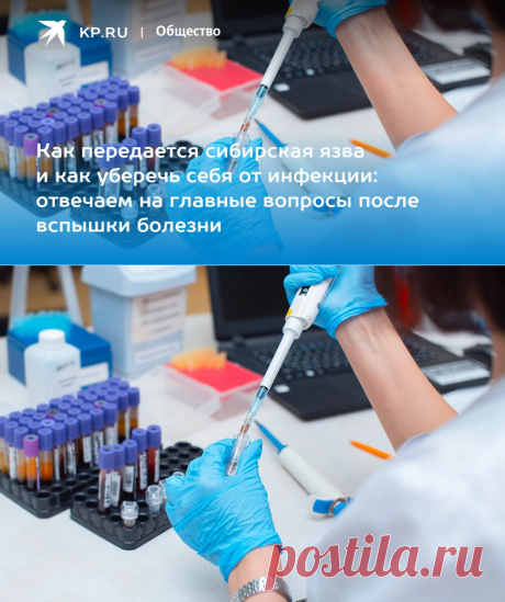 21-8-23-Сибирская язва у человека: симптомы, вакцина, лечение, профилактика - KP.RU