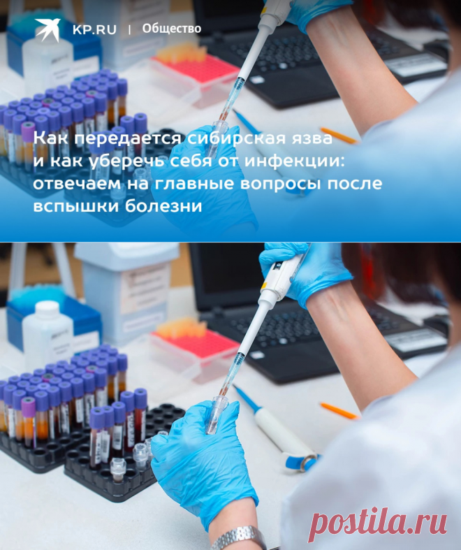 21-8-23-Сибирская язва у человека: симптомы, вакцина, лечение, профилактика - KP.RU