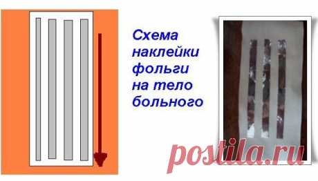 Как с помощью пищевой фольги снять любую боль | Я - Женщина