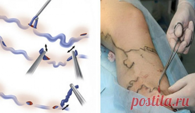 Image: ფეხით და იჯდეს ოპერაციის შემდეგ ... Found on Google from zdos.ru