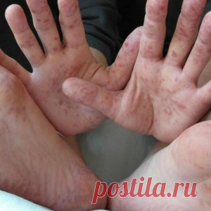 Новости - МирТесен