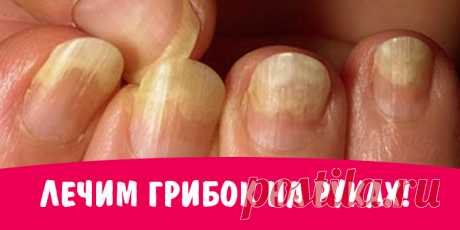 Лечим грибок на руках! | Полезные советы