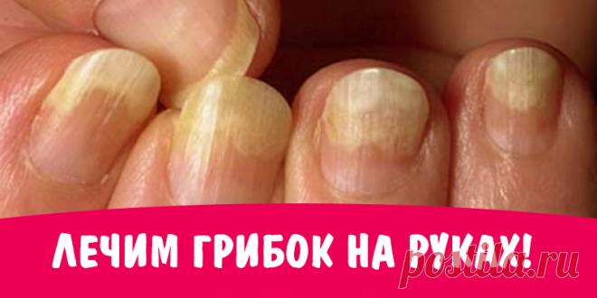 Лечим грибок на руках! | Полезные советы