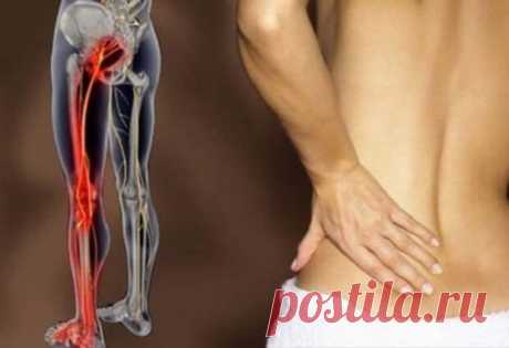 2 простых упражнения, чтобы разблокировать седалищный нерв